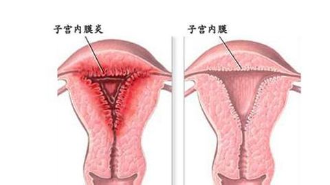 人流后的宫颈口图片图片